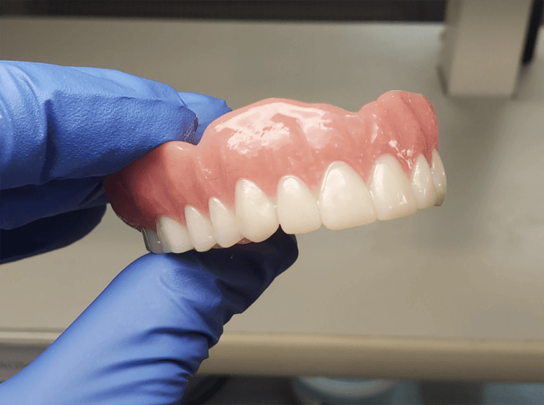 Full arch restoration