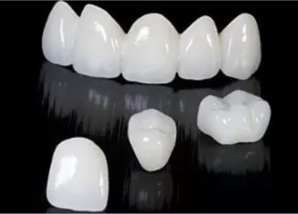 Zirconia restoration
